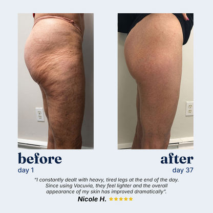 Vacuvia® SculptGlow™ Firmer, More Toned Skin