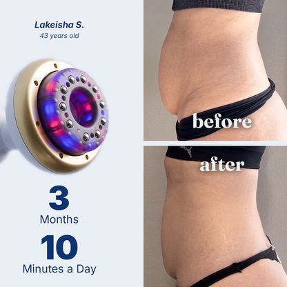 Vacuvia® SculptGlow™ Firmer, More Toned Skin